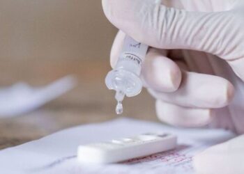 País registra 50.272 casos e 96 mortes em 24 horas