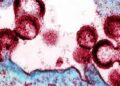 HIV: médicos anunciam 4º caso de cura