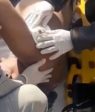 Base de guarda-sol perfura axila de turista