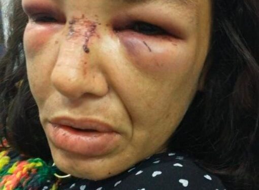 Guarda Municipal que agrediu mulher é preso dois meses após o crime