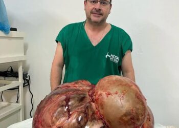 Tumor com cerca de 46 kg é retirado de mulher em cirurgia de emergência em Itaperuna