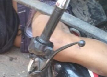 Jovem morre em acidente entre moto e ônibus em Campos