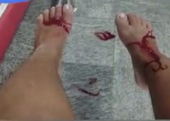 Garrafa de bebida explode e fere mulher em Búzios