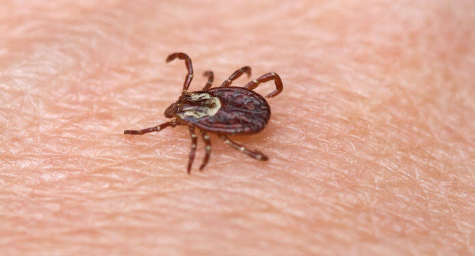 Criança de 7 anos morre de febre maculosa em Campos