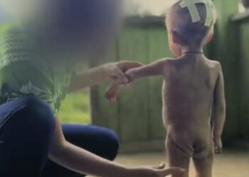 Quase 100 crianças morreram na maior reserva indígena do país: Yanomami