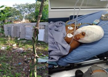 Menino de 06 anos é atacado por Pit Bull de canil clandestino em São Pedro da Aldeia