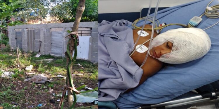 Menino de 06 anos é atacado por Pit Bull de canil clandestino em São Pedro da Aldeia