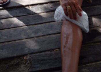 Tábua solta em deck causa ferimentos em morador