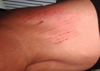 Denúncia: moradora com filha de colo cai em bueiro sem trava