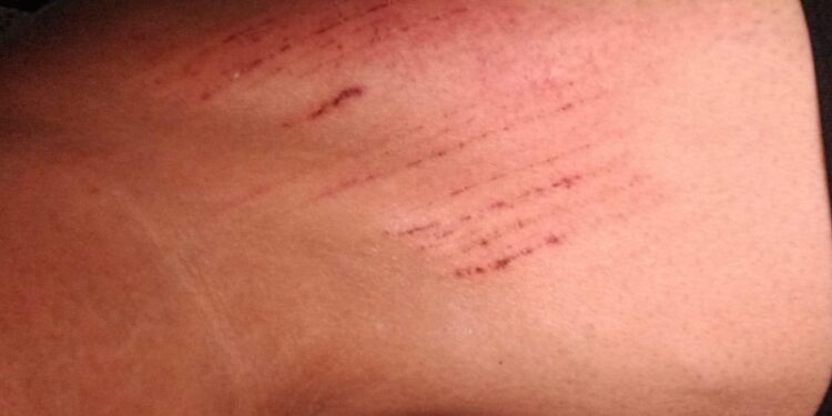 Denúncia: moradora com filha de colo cai em bueiro sem trava