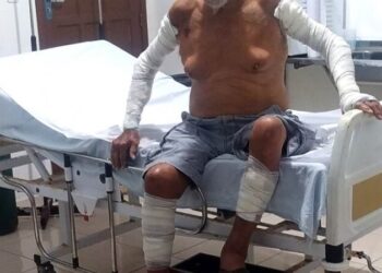 Idoso de 78 anos é espancado pela companheira em SJB