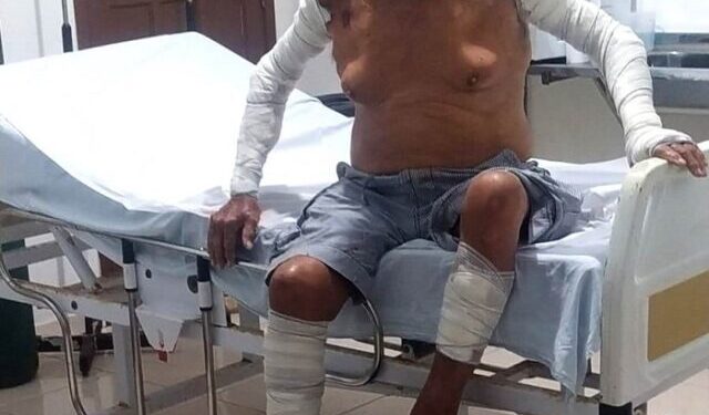 Idoso de 78 anos é espancado pela companheira em SJB