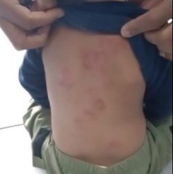 Polícia investiga caso de criança que teria sido mordida em creche em Campos