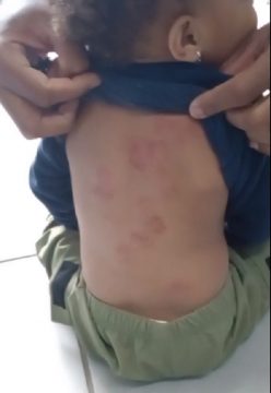 Polícia investiga caso de criança que teria sido mordida em creche em Campos