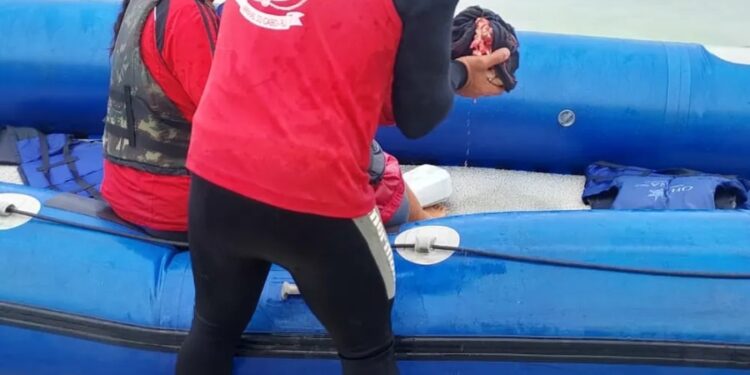 Fotógrafa Argentina sofre acidente em embarcação com hélice e tem a mão amputada em Arraial do Cabo