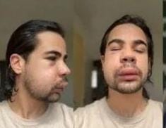 Delegada encerra investigação do caso de fotógrafo agredido