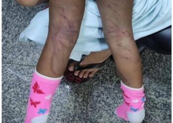 Suspeito de bater em enteada de dois anos com fio de televisão é preso em Campos