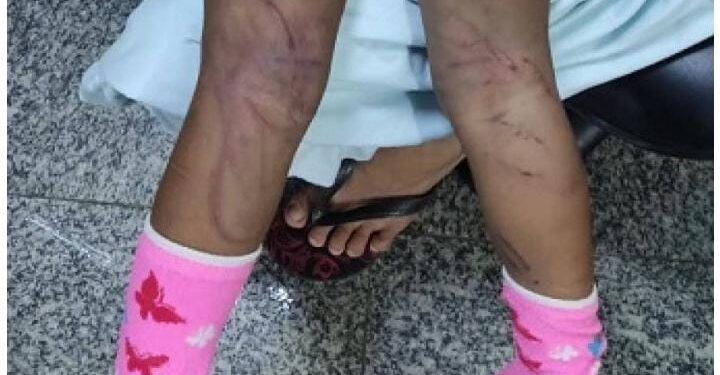 Suspeito de bater em enteada de dois anos com fio de televisão é preso em Campos