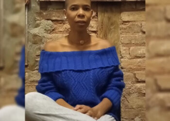 Setembro: mês de conscientização sobre a Alopecia Areata