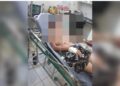 Criança forçada por madrasta a comer lagartixa recebe alta hospitalar