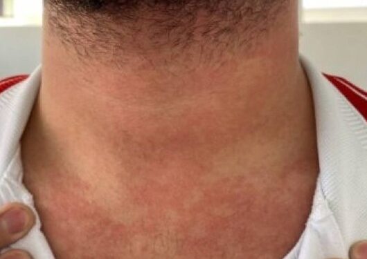 Professor é enforcado por aluno na sala de aula em Campos