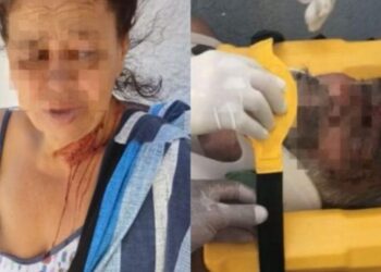 Casal de idosos é brutalmente espancado por vizinho em Araruama