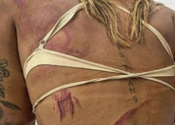 Assessora da vereadora é alvo de agressão e denuncia transfobia