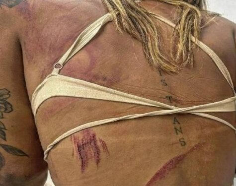 Assessora da vereadora é alvo de agressão e denuncia transfobia