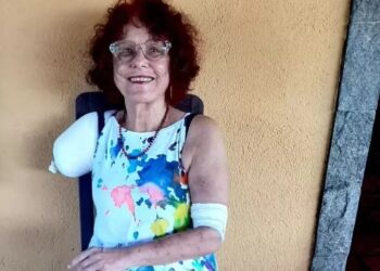 Justiça determina que Prefeitura de Saquarema e Governo do Estado do Rio paguem prótese biônica para Roseana Murray