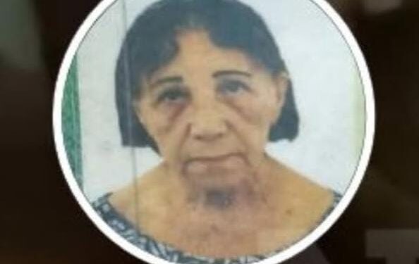 Morre mulher que teve perna amputada após ser atropelada em Macaé