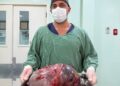 Tumor de 15kg é retirado de moradora de Rio das Ostras