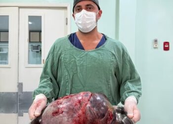 Tumor de 15kg é retirado de moradora de Rio das Ostras