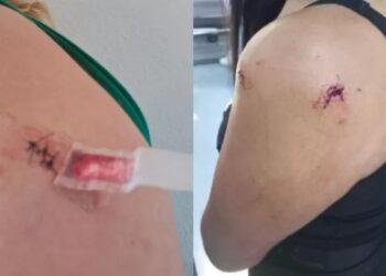 Jovem é esfaqueada pelo ex-namorado no Boulevard Canal, em Cabo Frio