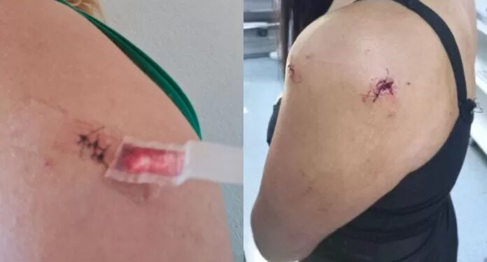 Jovem é esfaqueada pelo ex-namorado no Boulevard Canal, em Cabo Frio