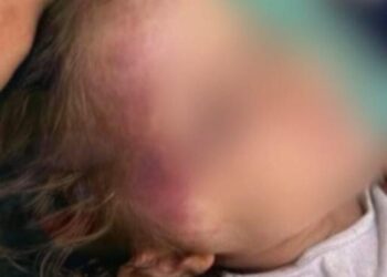 Justiça decreta prisão preventiva de homem acusado de torturar enteada de três anos