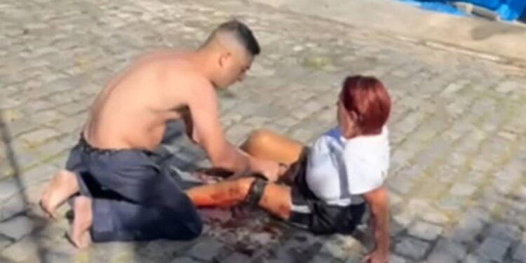 Mulher é atacada por pitbull dentro de condomínio em São Pedro da Aldeia