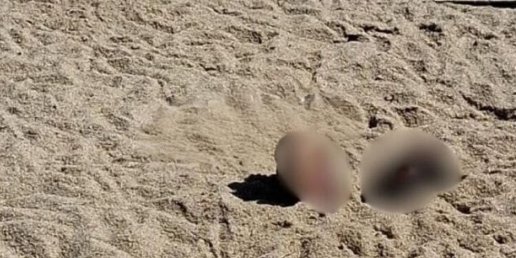 Homem é encontrado morto e parcialmente enterrado na praia