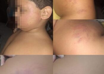 Mãe denuncia agressão contra filho autista dentro de escola
