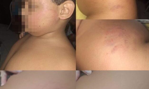 Mãe denuncia agressão contra filho autista dentro de escola