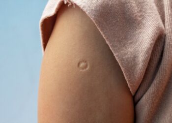 Aquela marquinha no seu braço direito… você sabe quanto ela custou?