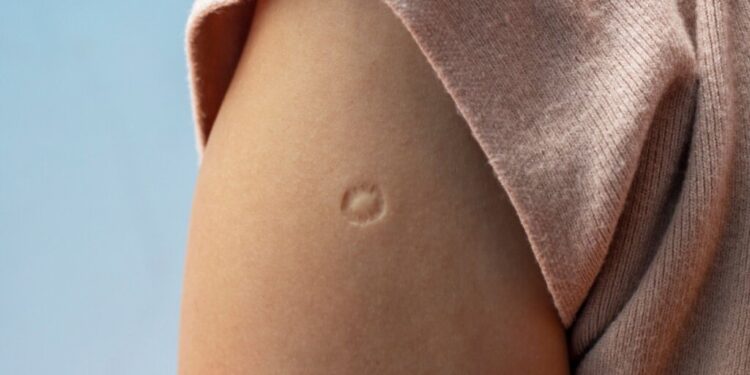 Aquela marquinha no seu braço direito… você sabe quanto ela custou?