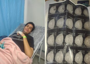 Aluno autista sofre fratura e família denuncia agressão em escola