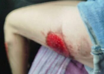 Arrastada no asfalto: assalto brutal choca moradores e acende alerta.