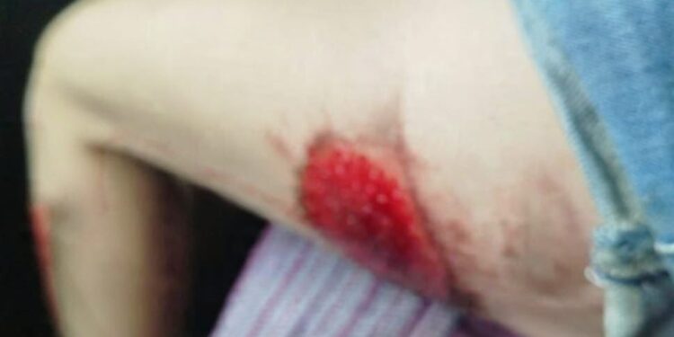 Arrastada no asfalto: assalto brutal choca moradores e acende alerta.