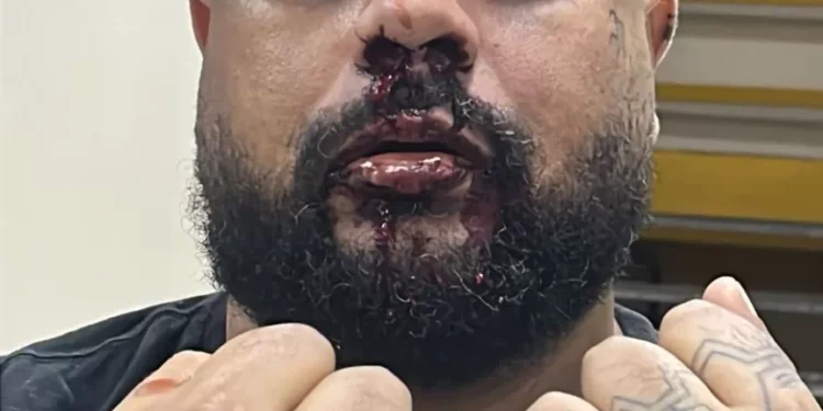 Denúncia de agressão em UPA gera polêmica e versões conflitantes