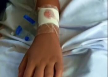 Pitbull ataca criança e deixa vítima em estado gravíssimo