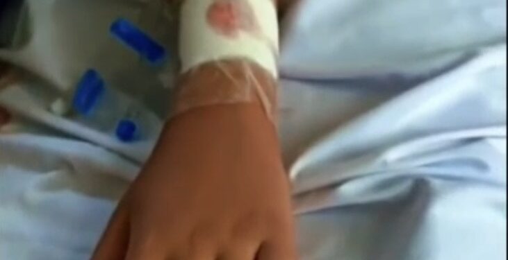 Pitbull ataca criança e deixa vítima em estado gravíssimo